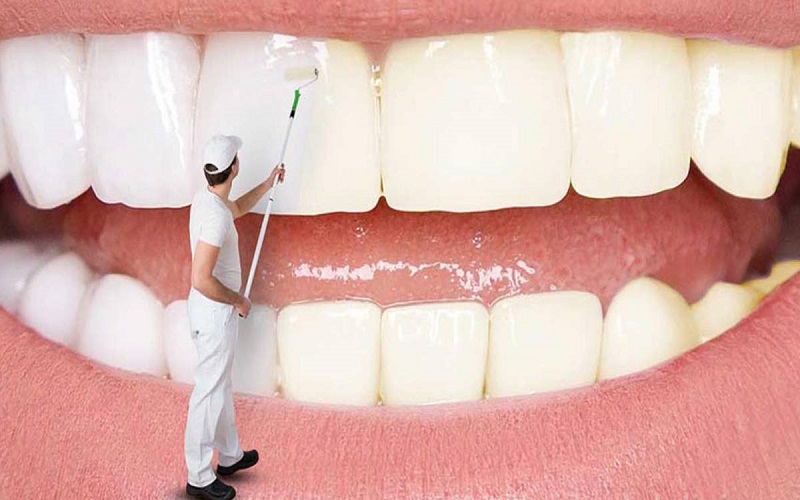 بهترین روش‌های سفید کردن دندان‌ها