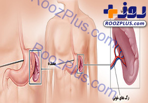 طحال چیست،کجاست و چه می کند؟/ سرنوشت قائدی پس از پارگی طحال چه خواهد شد؟