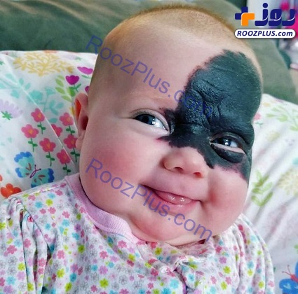 صورت عجیب نوزاد مادر و پدرش را به وحشت انداخت! +تصاویر
