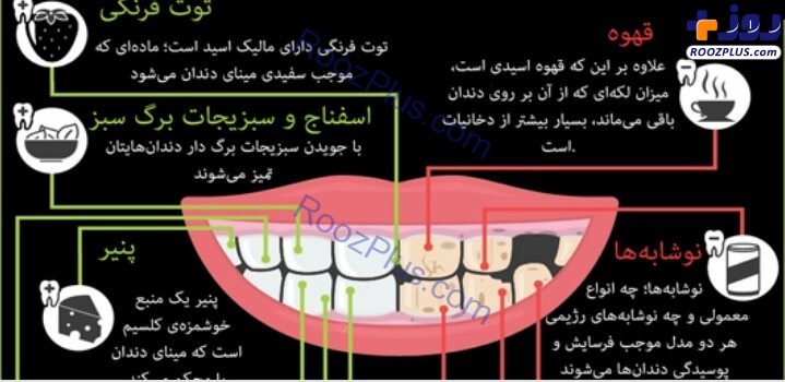 اینفوگرافیک/ مواد غذایی که باعث پوسیدگی دندان می‌شوند