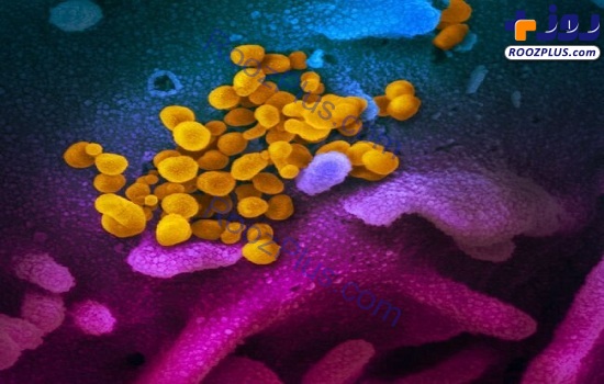 انتشار تصاویری واقعی از کروناویروس