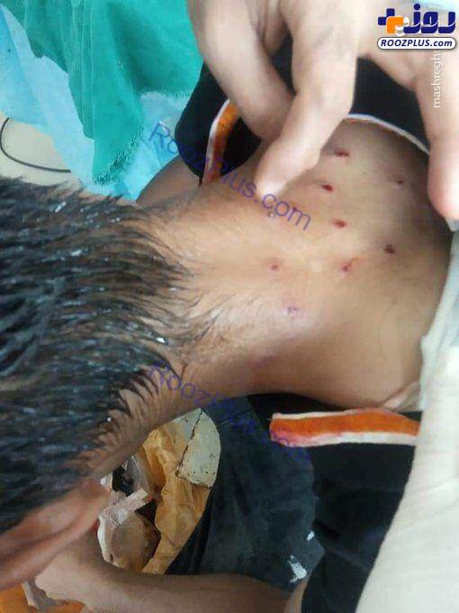مجروح شدن دلخراش عزاداران حسینی کشمیر هند +عکس
