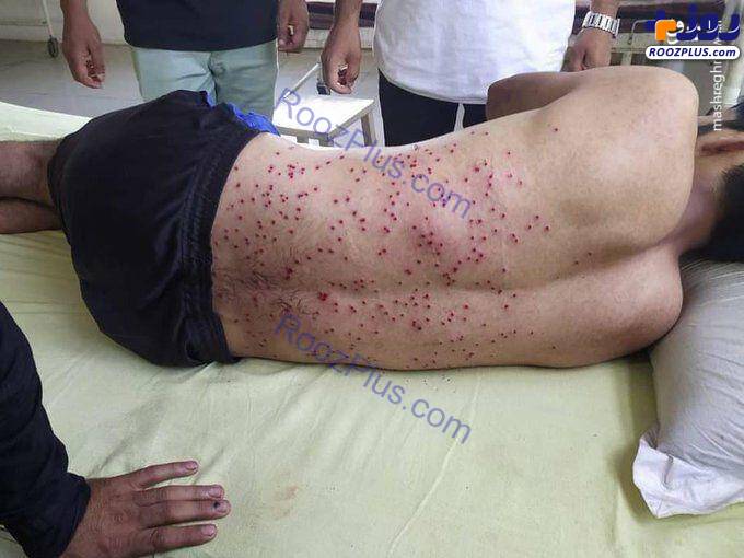 مجروح شدن دلخراش عزاداران حسینی کشمیر هند +عکس
