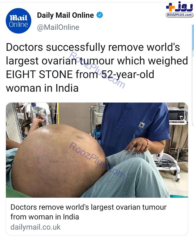 عکس/ عمل جراحی روی تومور ۵۰ کیلویی یک ز‌ن!
