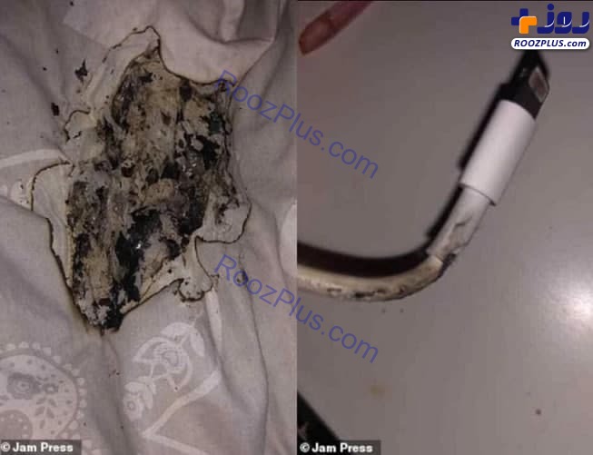 انفجار شارژر آیفون باعث سوختگی صورت دختر جوان شد انفجار شارژر آیفون باعث سوختگی صورت دختر جوان شد