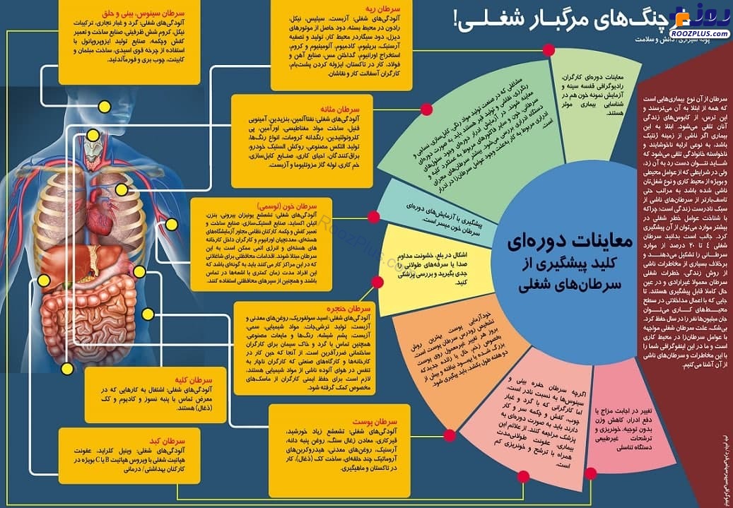 اینفوگرافیک/ شغل شما مستعد چه نوع سرطانی است؟