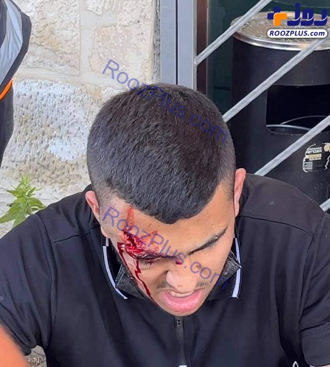 عکس/ شلیک به جوان فلسطینی از فاصله صفر