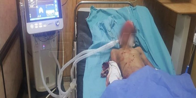 انفجار در سوریه به کشته شدن 2 غیرنظامی و زخمی شدن 6 کودک منجر شد