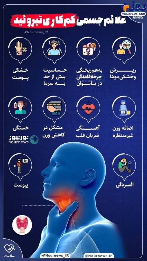 اینفموگرافیک/ علائم جسمی کم کاری تیروئید را بشناسید
