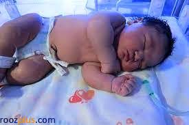 به دنیا آمدن نوزاد 7 کیلوگرمی+ عکس