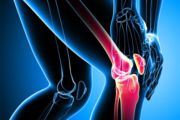 ابتلای بیش از ۲۰۰ میلیون نفر به پوکی استخوان در جهان / سهم بالاتر ابتلا در زنان