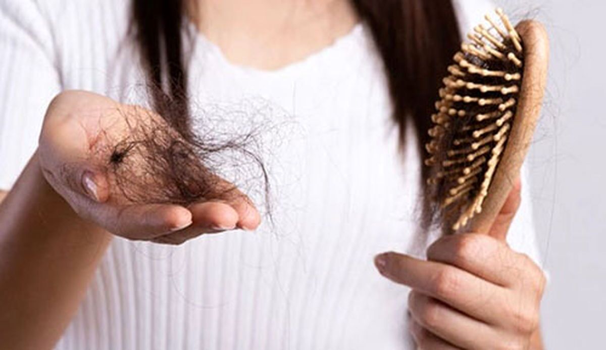 پنج علت ریزش مو در زنان