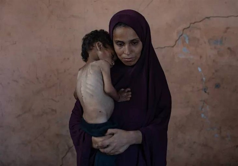 مدیر امداد پزشکی غزه: ۱۷ هزار کودک از سوءتغذیه شدید رنج می‌برند