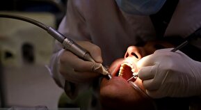 دندان‌های کودکان از چه زمانی نیاز به مراقبت دارند؟