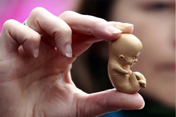 روزانه تا هزار سقط جنین در کشور/آماری ۳۰ برابر تلفات تصادفات! روزانه تا هزار سقط جنین در کشور/آماری ۳۰ برابر تلفات تصادفات!