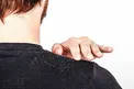 5 عامل اصلی شوره سر را بشناسید