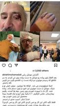 ابطحی مجروح شد/ سارقین ناکام ماندند+ عکس