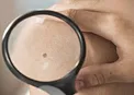 خال هایی که نشانه ی سرطان دارند