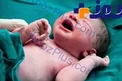 اصرار پزشک بر زایمان طبیعی مادر منجر به مرگ نوزاد شد