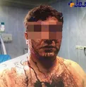 حمله وحشیانه سارقان در شهرزیبا تهران +عکس