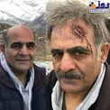 پیشانی خونین بازیگر لیسانسه ها+عکس