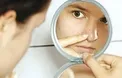 چگونه از صورتمان بفهمیم که بدنمان کمبود مواد مغذی دارد؟