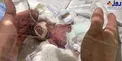 تولد کوچک‌ترین نوزاد پسر جهان در توکیو +عکس
