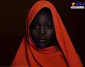 رنگ پوست عجیب دختر مدل+عکس