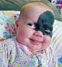خال عجیب این دختر  روی صورتش!/عکس