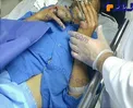 انگشترهایی که یک نفر را راهی بیمارستان کردند+ عکس