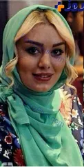 جدیدترین عکس از چهره تغییر یافته سحر قریشی