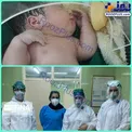 تصویری از تولد نوزاد متولد شده از مادر مبتلا به کرونا در بابل