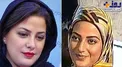 عکس/ تغییر چهره طناز طباطبایی بعد از ۱۷ سال