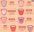 اینفوگرافیک/ رنگ زبان نشانه چه بیماری است؟