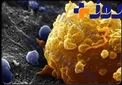 ارتباط مستقیم رنگ مو با سرطان سینه در خانم‌ها!