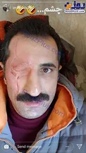 چهره عجیب و ترسناک بازیگر سینما و تلویزیون+عکس