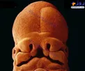 تصویری عجیب از جنین انسان در پنج هفتگی!