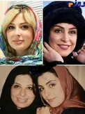 تغییرات ظاهری عجیب دو بازیگر زن مشهور در گذر زمان+عکس