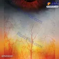 چشم انسان از نزدیک ترین نما !+عکس