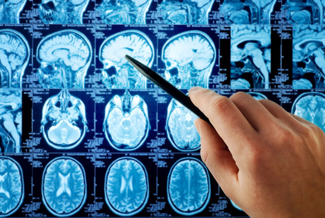 افزایش امنیت هوش مصنوعی در تحلیل MRI مغز با راه حل پژوهشگران دانشگاهی افزایش امنیت هوش مصنوعی در تحلیل MRI مغز با راه حل پژوهشگران دانشگاهی