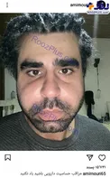 حساسیت عجیب آقای بازیگر به مصرف دارو!+عکس