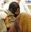 کشف دختر 14-15 ساله منجمد شده متعلق به 500 سال پیش/عکس