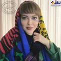تغییرات ظاهری و چهره متفاوت خانم بازیگر+عکس