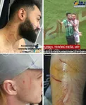 حمله با تیغ به بازیکنان در زمین فوتبال!+عکس