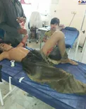 عکس/ حمله گاندو به یک نوجوان در پیشین (18+)