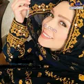 لباس محلی و عجیب بازیگر زن مشهور+عکس