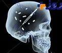 مواد مخدر به این دلیل مغز را از کار می‌اندازد