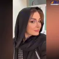 نیوشا ضیغمی بعد از جراحی دوباره بینی اش/عکس