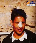 وقتی فرهاد مجیدی مجبور شد بینی‌اش را عمل کند +عکس