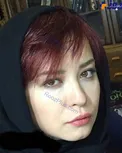 تغییر چهره بازیگر زن مشهور+ عکس